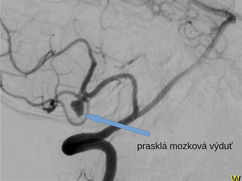 1108mozek2 c69e7