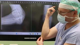 MUDr. Jiř&iacute; Jurča, Ph.D., prim&aacute;ř Ortopedick&eacute;ho oddělen&iacute; Nemocnice Chomutov. Na monitoru sn&iacute;mek rozpadl&eacute;ho lokte. Foto: Krajsk&aacute; zdravotn&iacute;