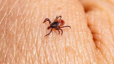 Ústecký kraj hlásí rekordní nárůst klíšťové encefalitidy i lymské borreliózy. Nejvíce ohrožení jsou lidé nad 50 let
