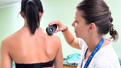 Vyšetření znamének je nejméně bolestivé preventivní vyšetření vůbec. Choďte každý rok