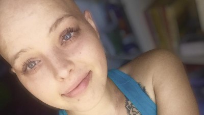 Karolína Zohová se zapojila do projektu Fuck Cancer.