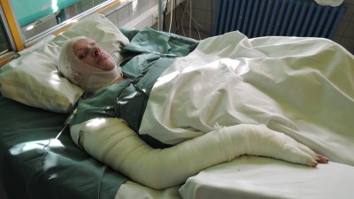 Rok od tragick&eacute;ho pož&aacute;ru v Mostě: Hrdina Jirka se vr&aacute;til do plamenů pro ciz&iacute; ženu. Teď vyhl&iacute;ž&iacute; konec l&eacute;čby