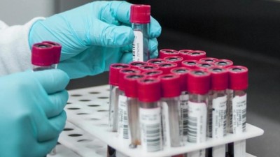 Ilustračn&iacute; sn&iacute;mek. Zdroj: Pixabay / CC0